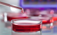 petri_dish_pipetting_haematology_19970057_785x400px.jpg