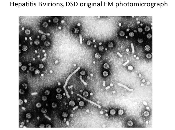 A photomicrograph of the 42 nm double-shelled HBV virion.jpg