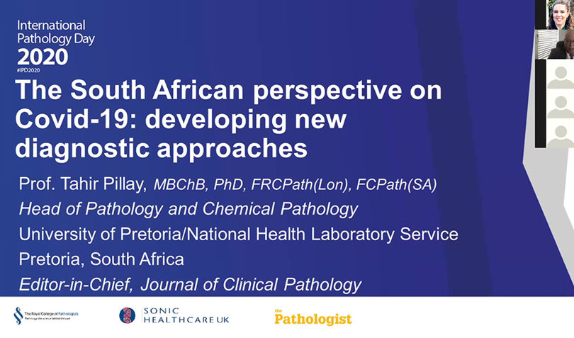 The South African perspective on Covid-19: developing new diagnostic approaches