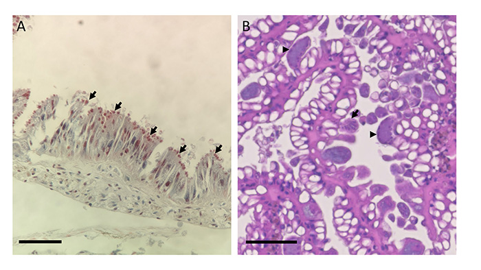 Microscope images of the showing parasites in the small intestines and renal cells of Partula snails.